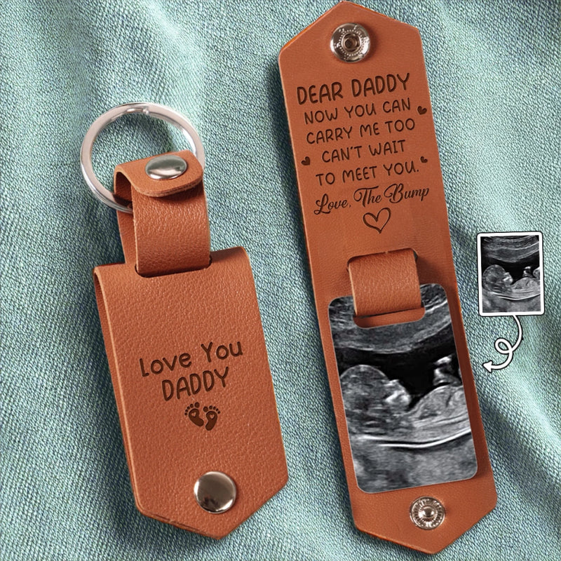 Personalized Photo Engraved Leather Keychain – Gifts For New Dads, Grandpas – Your Little Miracle Is On The Way